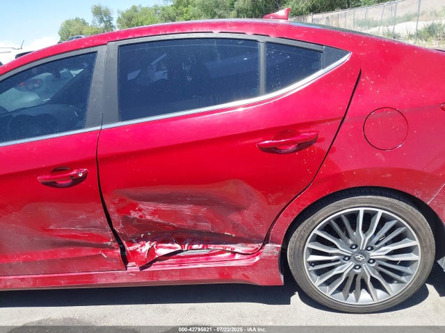 KMHD04LB0JU608208 Hyundai g 1.6 dohc t-gdi