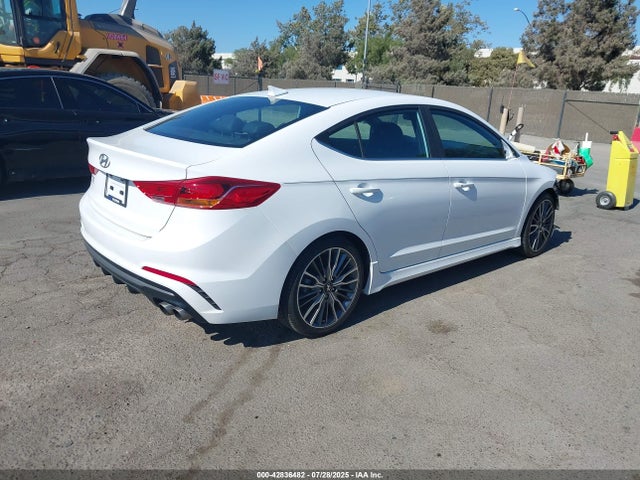 KMHD04LB6JU564554 Hyundai g 1.6 dohc t-gdi