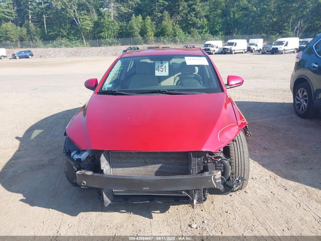 KMHD74LF1HU123827 Hyundai 2017