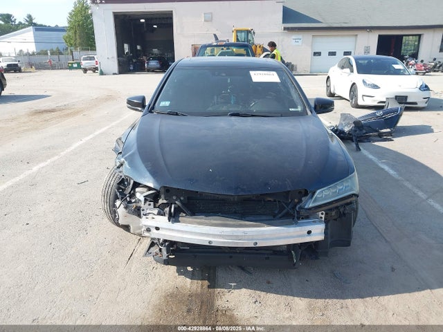 Acura k24w7 2015 19UUB1F59FA010566 Image 12