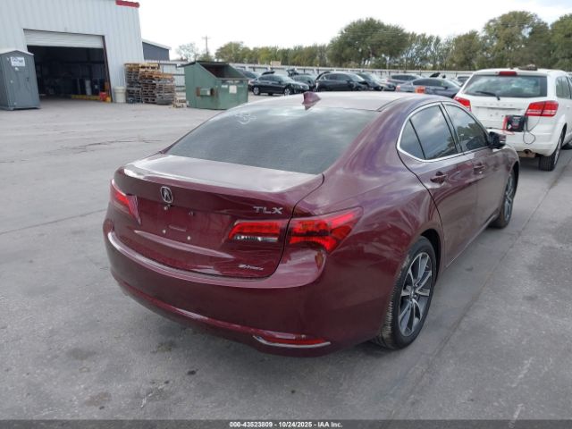 2015 ACURA TLX 19UUB3F5XFA006523 Photo 3