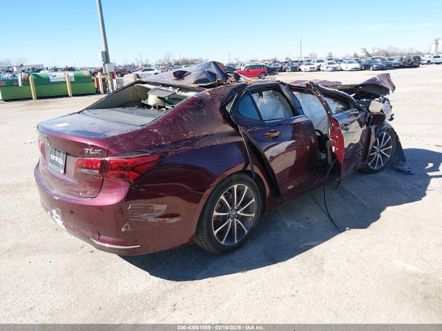 2015 ACURA TLX 19UUB2F51FA004539 Photo 3