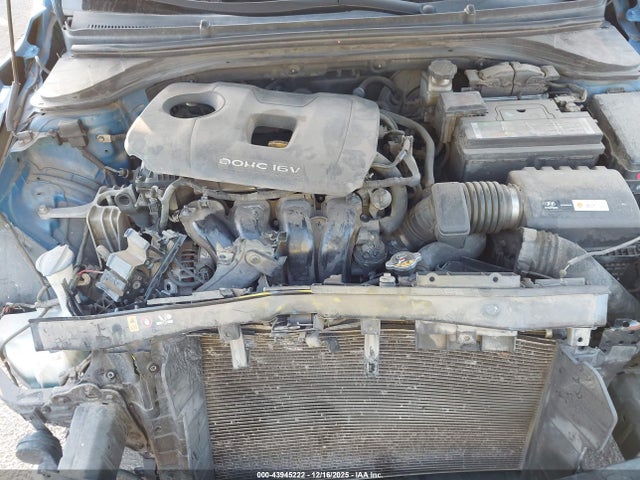 KMHD74LF9HU122859 Hyundai ELANTRA SE