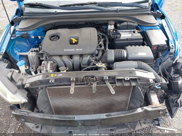 KMHD74LF5JU607571 Hyundai ELANTRA SE