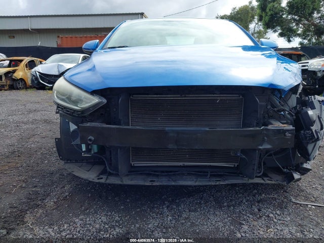 KMHD74LF5JU607571 Hyundai ELANTRA SE