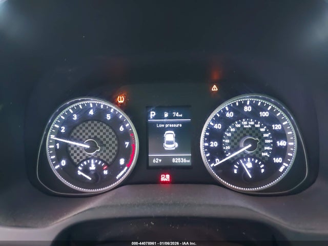KMHD84LF5KU872778 Hyundai ELANTRA SEL