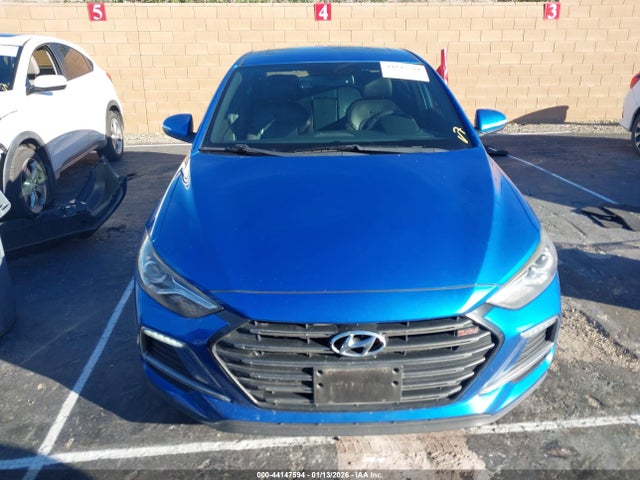KMHD04LBXJU453733 Hyundai Elantra Sport