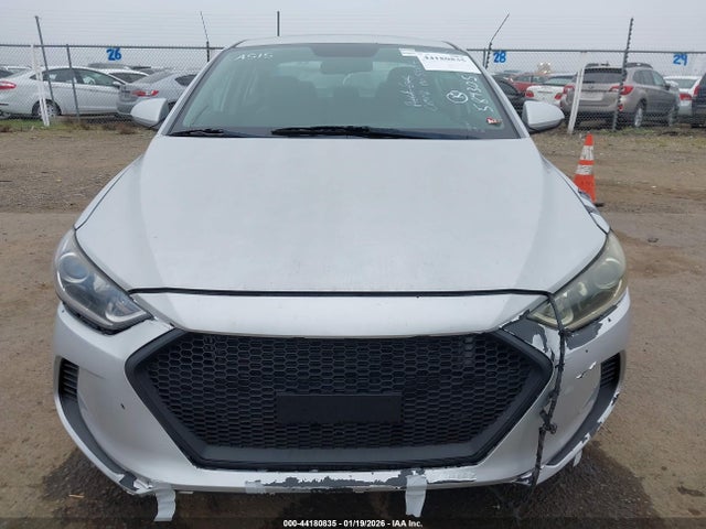 KMHD84LF3JU584305 Hyundai ELANTRA SEL