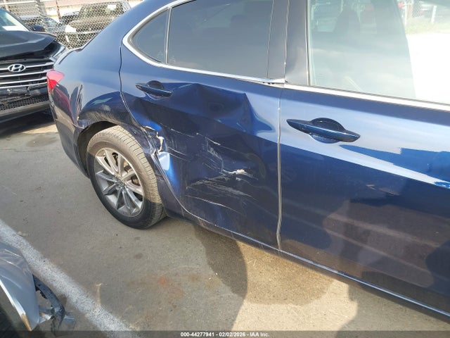 Acura TLX 2018 19UUB1F34JA009963 Image 17