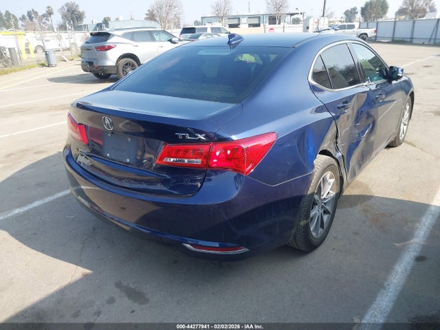 Acura TLX 2018 19UUB1F34JA009963 Image 4