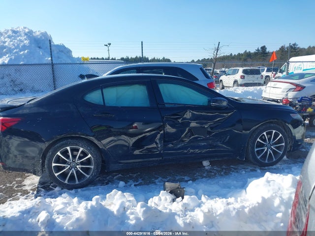 Acura Tlx V6 Tech 2015 19UUB3F58FA009954 Image 13