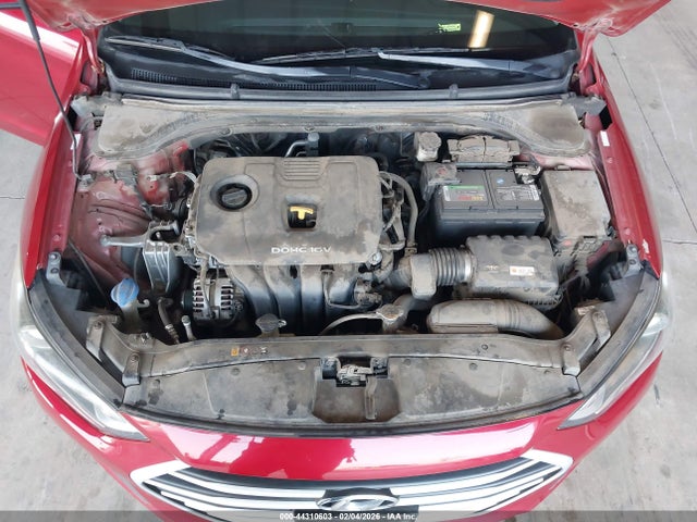 KMHD84LF9JU598810 Hyundai ELANTRA SEL