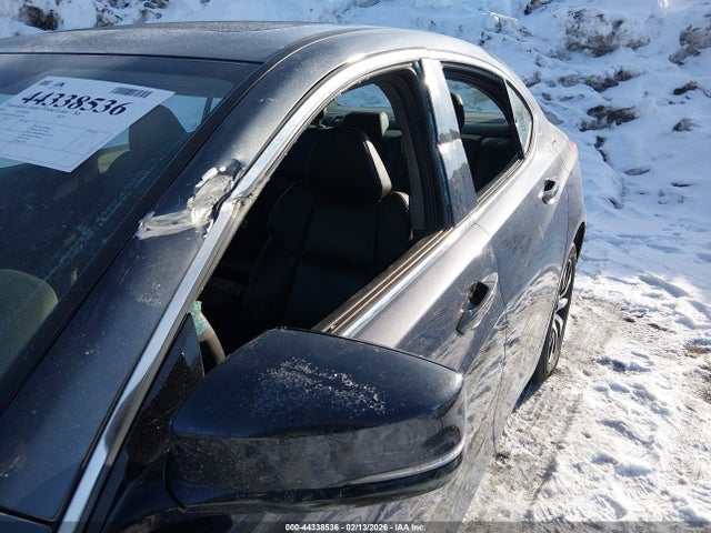 Acura TLX 2016 19UUB1F30GA011914 Image 6