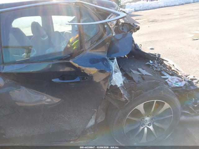 2015 ACURA TLX 19UUB1F35FA016539 Photo 5