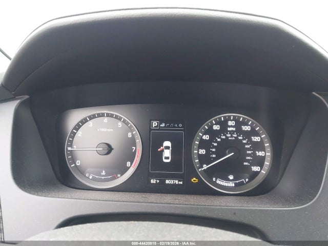 5NPE34AF1GH284761 Hyundai Sonata Limited