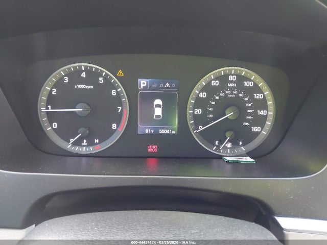 5NPE34AFXFH123906 Hyundai Sonata Sport
