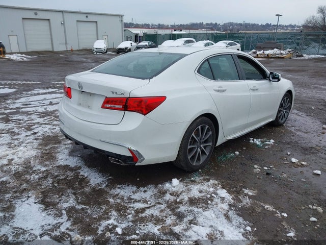 2018 ACURA TLX 19UUB2F51JA012925 Photo 3