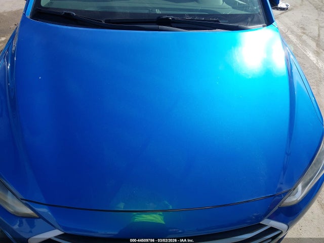 KMHD74LF5HU353662 Hyundai ELANTRA SE