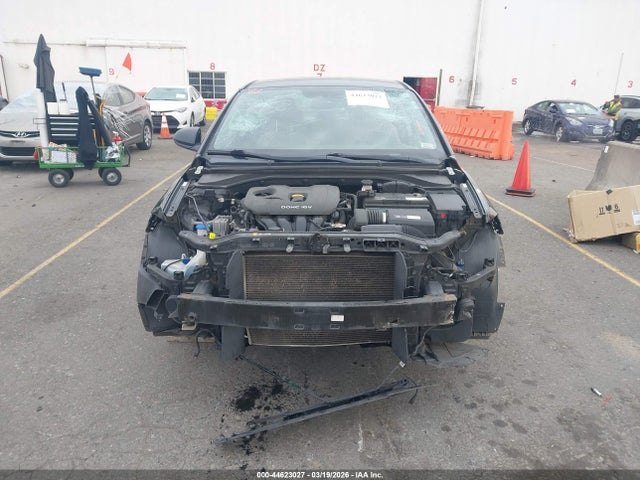 KMHD74LF0JU473259 Hyundai ELANTRA SE