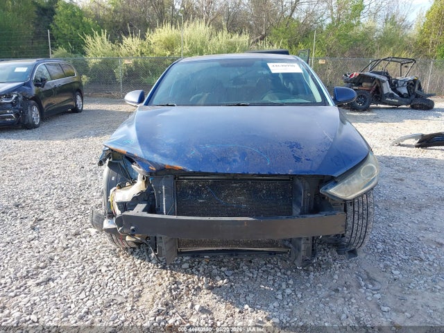 KMHD74LF0HU406381 Hyundai ELANTRA SE