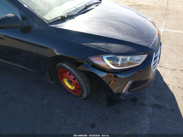 KMHD84LF7HU106141 Hyundai ELANTRA SE