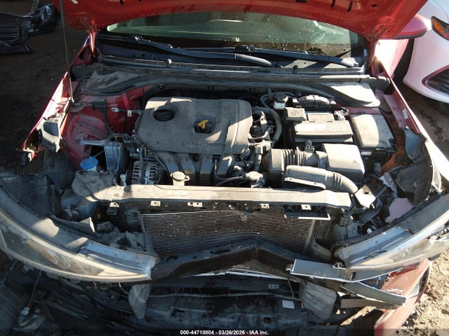 KMHD74LF1LU988984 Hyundai ELANTRA SE