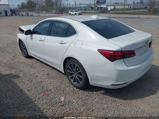 19UUB2F56HA000540 Acura Tlx Technology Package