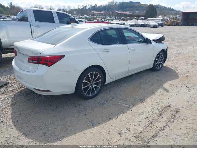 19UUB2F56HA000540 Acura Tlx Technology Package