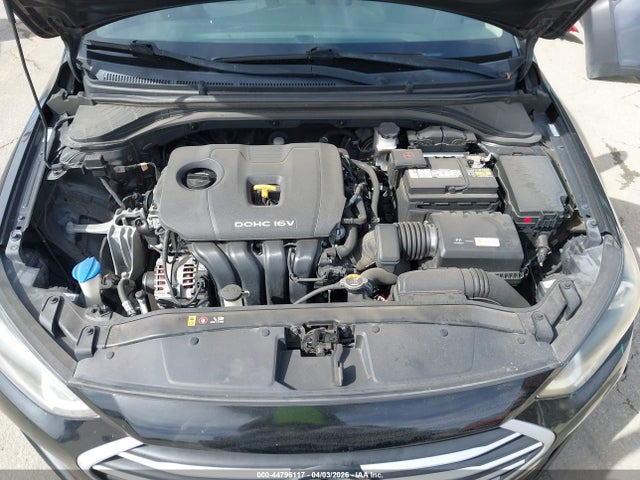 KMHD84LF0JU664905 Hyundai ELANTRA SEL