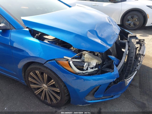5NPD84LF1JH294451 Hyundai ELANTRA SEL