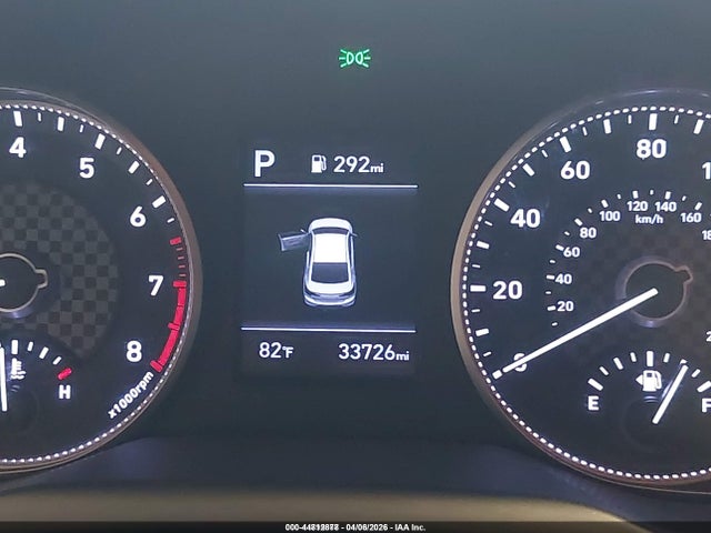 5NPD74LF1LH615782 Hyundai ELANTRA SE