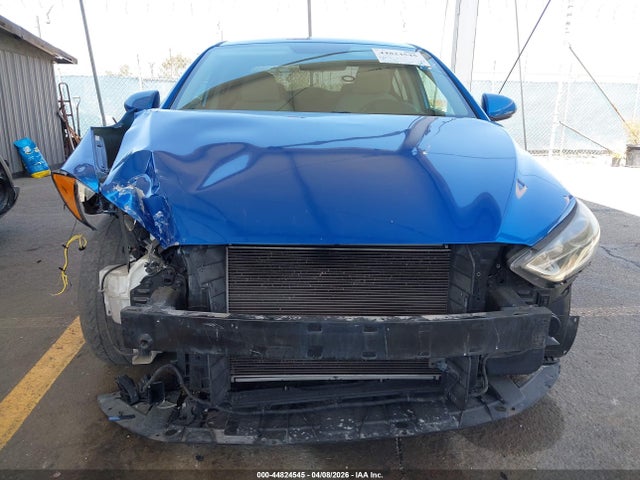KMHD84LF1HU404801 Hyundai ELANTRA SE