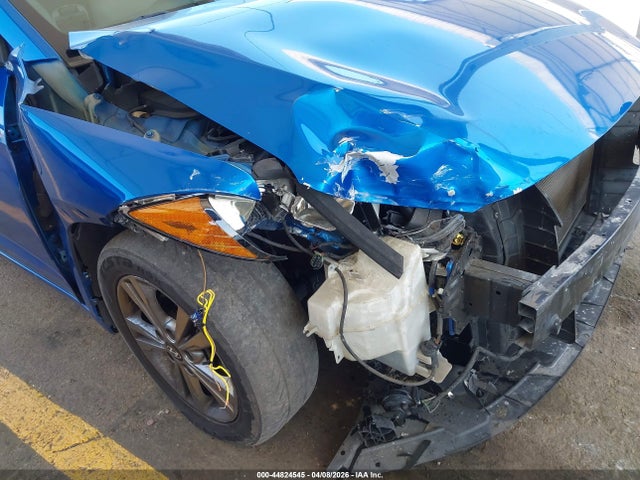 KMHD84LF1HU404801 Hyundai ELANTRA SE