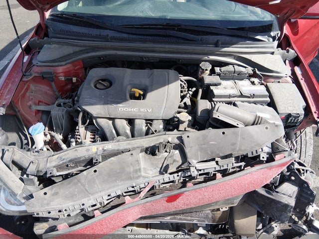 KMHD84LF2HU397194 Hyundai ELANTRA SE