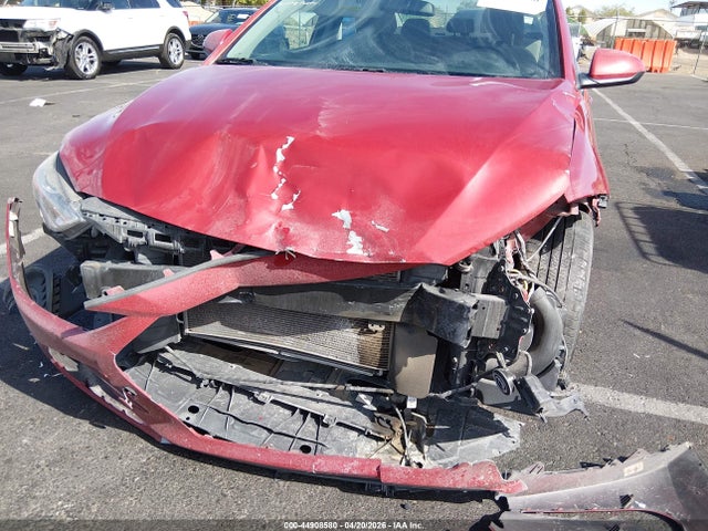 KMHD84LF2HU397194 Hyundai ELANTRA SE