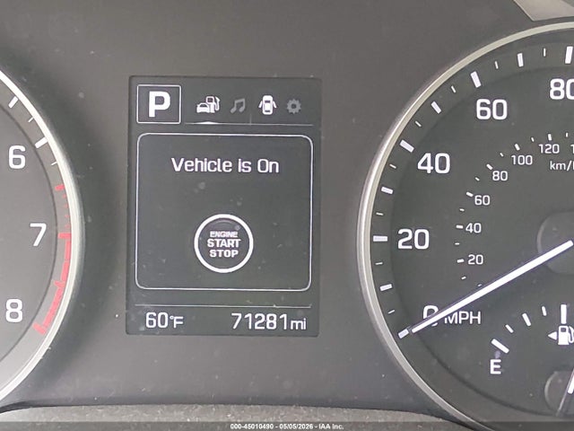 45010490 :رقم المزاد ، 5NPD84LFXHH200030 vin ، 2017 Hyundai Elantra Value Edition مزاد بيع