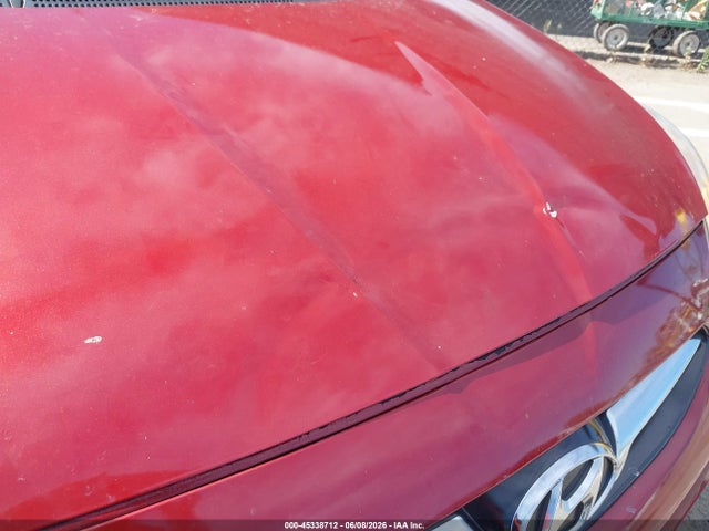Aukcja sprzedaży 2017 Hyundai Accent Se, vin: KMHCT4AE2HU389343, numer aukcji: 45338712