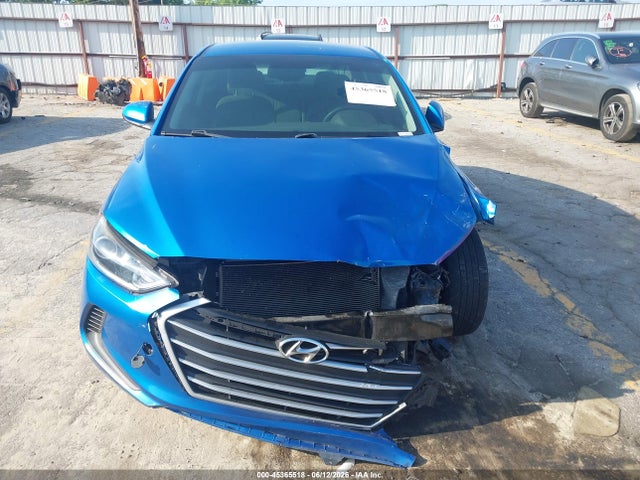 45365518 :رقم المزاد ، KMHD84LF3JU657334 vin ، 2018 Hyundai Elantra Sel مزاد بيع
