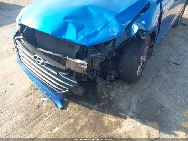 45365518 :رقم المزاد ، KMHD84LF3JU657334 vin ، 2018 Hyundai Elantra Sel مزاد بيع