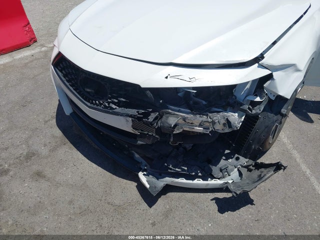 Acura Tlx A-spec Package 2021 19UUB6F52MA011276 Image 6