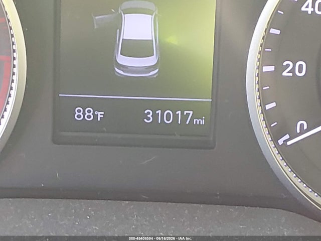 5NPD74LF1LH602806 Hyundai ELANTRA SE