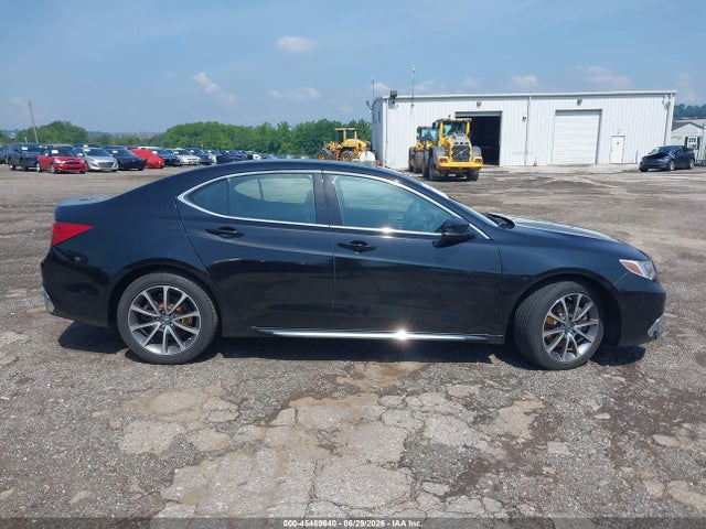Acura Tlx Tech Pkg 2018 19UUB3F5XJA005493 Image 12
