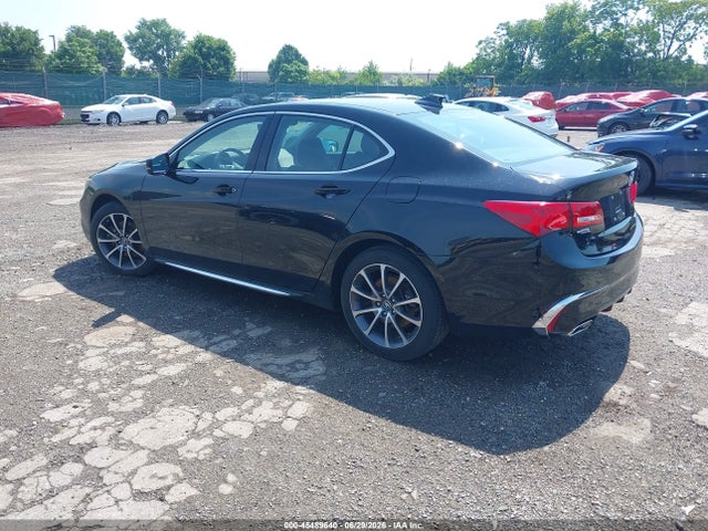 Acura Tlx Tech Pkg 2018 19UUB3F5XJA005493 Image 3