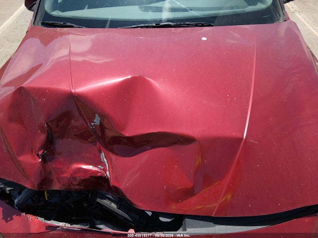 KMHLM4DG5RU711372 Hyundai ELANTRA SEL