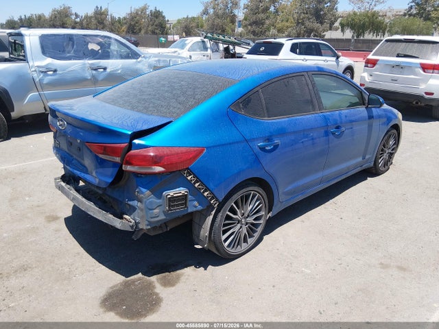 KMHD74LF8JU450439 Hyundai ELANTRA SE