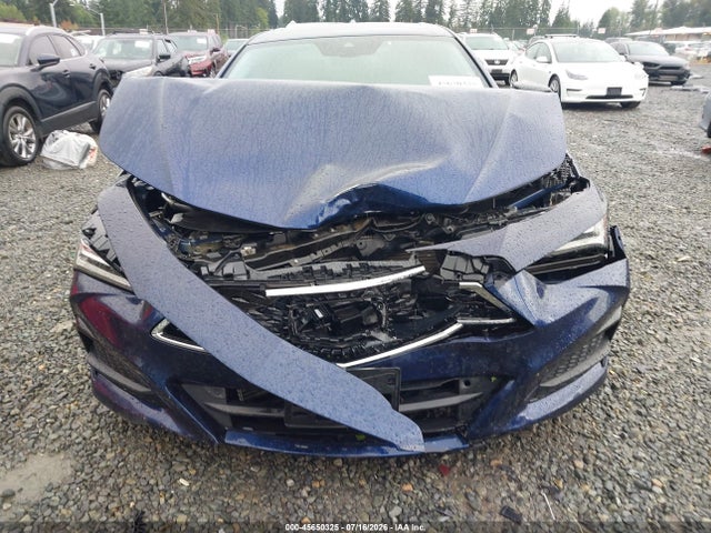 Acura Tlx Technology Package 2022 19UUB6F46NA001536 Image 12