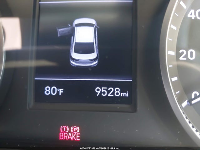5NPD74LF5LH613663 Hyundai ELANTRA SE
