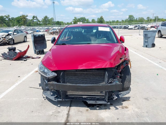 KMHD84LFXHU208369 Hyundai ELANTRA SE