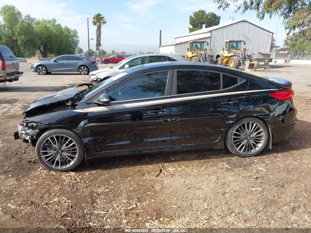 KMHD04LBXJU599338 Hyundai Elantra Sport