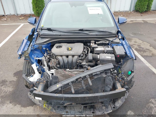 Hyundai Elantra Limited 2017 5NPD84LF9HH005598 Image 10